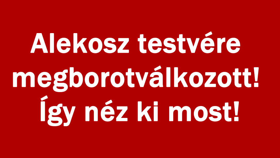 Alekosz testvére megborotválkozott! Így néz ki most!